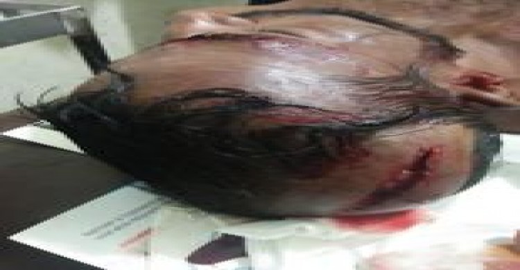 মানিকছড়িতে ত্রিপুরা প্রতিপক্ষের হামলায় আহত আব্দুল হালিমের মৃত্যু