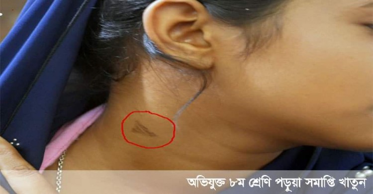 শালী বিয়ে না করলে বোনকে তালাক ! দুলাভাইয়ের হুমকি